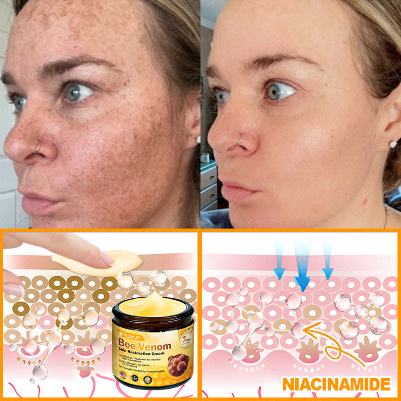 Made and Shipped from USA ✨ VLSVLS® Bee Venom Skin Restoration Cream with Collagen & Matrixyl 3000 | Obesity🔥 Sagging Skin, Fine Lines, Loss of Firmness, Flat Bust, Drooping Hips, and More🔥 LAST DAY 80% OFF 🗽