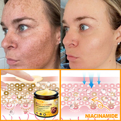 Made and Shipped from USA ✨ VLSVLS® Bee Venom Skin Restoration Cream with Collagen & Matrixyl 3000 | Obesity🔥 Sagging Skin, Fine Lines, Loss of Firmness, Flat Bust, Drooping Hips, and More🔥 LAST DAY 80% OFF 🗽