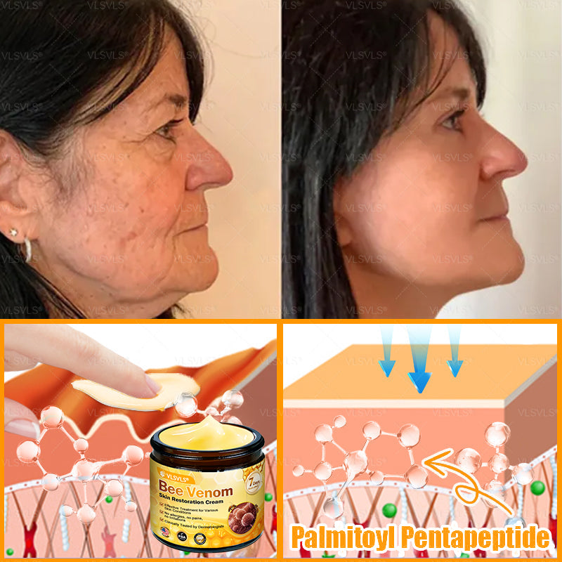 Made and Shipped from USA ✨ VLSVLS® Bee Venom Skin Restoration Cream with Collagen & Matrixyl 3000 | Obesity🔥 Sagging Skin, Fine Lines, Loss of Firmness, Flat Bust, Drooping Hips, and More🔥 LAST DAY 80% OFF 🗽