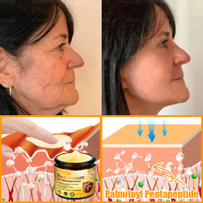 Made and Shipped from USA ✨ VLSVLS® Bee Venom Skin Restoration Cream with Collagen & Matrixyl 3000 | Obesity🔥 Sagging Skin, Fine Lines, Loss of Firmness, Flat Bust, Drooping Hips, and More🔥 LAST DAY 80% OFF 🗽