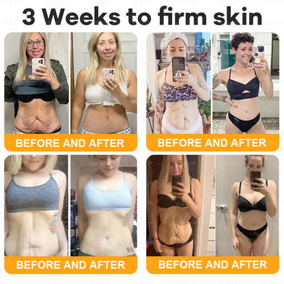 Made and Shipped from USA ✨ VLSVLS® Bee Venom Skin Restoration Cream with Collagen & Matrixyl 3000 | Obesity🔥 Sagging Skin, Fine Lines, Loss of Firmness, Flat Bust, Drooping Hips, and More🔥 LAST DAY 80% OFF 🗽