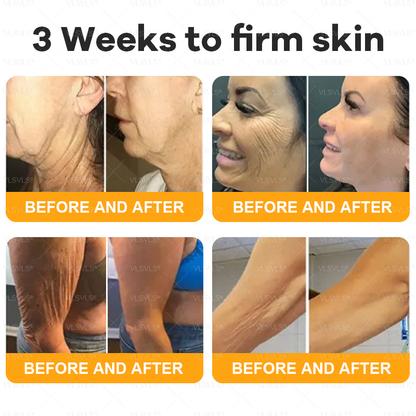 Made and Shipped from USA ✨ VLSVLS® Bee Venom Skin Restoration Cream with Collagen & Matrixyl 3000 | Obesity🔥 Sagging Skin, Fine Lines, Loss of Firmness, Flat Bust, Drooping Hips, and More🔥 LAST DAY 80% OFF 🗽