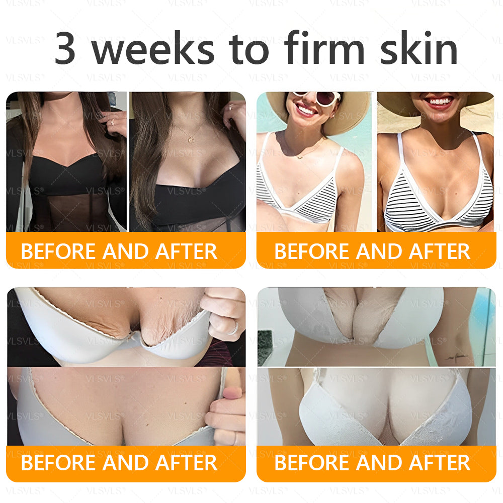 Made and Shipped from USA ✨ VLSVLS® Bee Venom Skin Restoration Cream with Collagen & Matrixyl 3000 | Obesity🔥 Sagging Skin, Fine Lines, Loss of Firmness, Flat Bust, Drooping Hips, and More🔥 LAST DAY 80% OFF 🗽