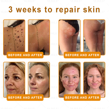 Made and Shipped from USA ✨ VLSVLS® Bee Venom Skin Restoration Cream with Collagen & Matrixyl 3000 | Obesity🔥 Sagging Skin, Fine Lines, Loss of Firmness, Flat Bust, Drooping Hips, and More🔥 LAST DAY 80% OFF 🗽